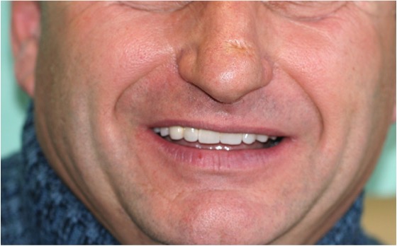 denti di signore